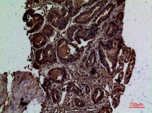 Immunohistochemical analysis of paraffin-embedded human prostate cancer using Anti-CD300LG Antibody