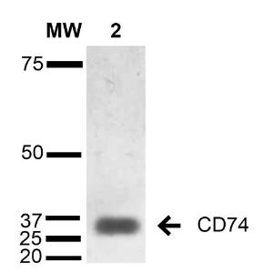 Western blot analysis of human Lymphoblastoid cell line (Raji) showing detection of 33-35 kDa CD74 protein using Anti-CD74 Antibody [1B8 ] (A304844) at 1:1000 for 2 hours at room temperature