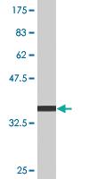 Anti-PXDN Mouse Monoclonal Antibody [clone: 2C11]