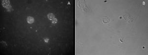 Anti-FOXP3 Antibody (A82808) staining of CD25-sorted (Treg) Human blood cells gathered by cytospin and detected by FITC (A) and in phase contrast (B)