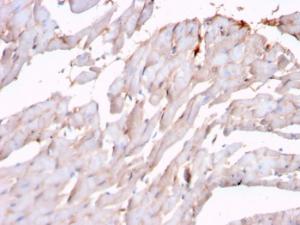 Anti-N Cadherin Mouse Recombinant Antibody [clone: rCDH2/1426]