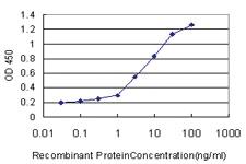 Anti-FBXO11 Mouse Monoclonal Antibody [clone: 4C12]