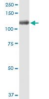 Anti-ITIH1 Polyclonal Antibody Pair