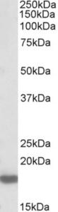 EB09595 (0.3 µg/ml) staining of Rat Brain lysate (35 µg protein in RIPA buffer). Primary incubation was 1 hour. Detected by chemiluminescence.