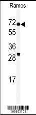 Anti-RIOK2 Rabbit Polyclonal Antibody (Biotin)