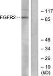 Anti-FGFR2 Rabbit Polyclonal Antibody