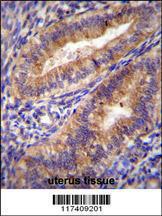 Anti-PTGS2 Rabbit Polyclonal Antibody (Biotin)