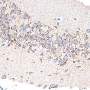 Immunohistochemistry analysis of paraffin-embedded mouse brain using Anti-PAK3 Antibody [ARC1955] (A307726) at a dilution of 1:100 (40x lens). Perform microwave antigen retrieval with 10 mM Tris/EDTA buffer pH 9.0 before commencing with IHC staining protocol.