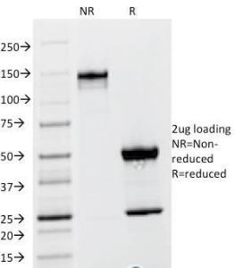 SDS-PAGE analysis of Anti-TSH beta Antibody [TSHb/1317] under non-reduced and reduced conditions; showing intact IgG and intact heavy and light chains, respectively. SDS-PAGE analysis confirms the integrity and purity of the Antibody