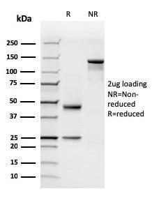 Anti-N Cadherin Mouse Recombinant Antibody [clone: rCDH2/1426]