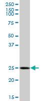 Anti-GOSR1 Mouse Polyclonal Antibody