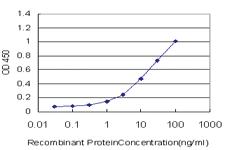 Anti-GEMIN7 Mouse Monoclonal Antibody [clone: 2E2]