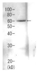 Anti-Rpn3 Antibody