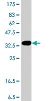 Anti-FPGS Mouse Polyclonal Antibody