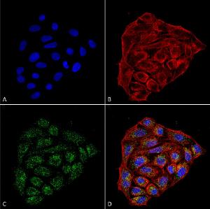 Immunocytochemistry/Immunofluorescence analysis of human cervical cancer cell line (HeLa), fixed in 4% formaldehyde for 15 min at room temperature, using Anti-CD74 Antibody [1B8 ] (A304844), at 1:100 for 60 minutes at room temperature