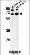 Anti-BEST2 Rabbit Polyclonal Antibody