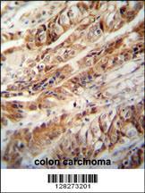 Anti-ZC3H15 Rabbit Polyclonal Antibody (PE (Phycoerythrin))