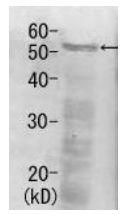 Anti-Rpn5 Rabbit Polyclonal Antibody