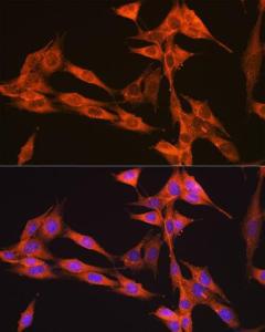 Anti-VPS34 Rabbit Monoclonal Antibody [clone: ARC0286]