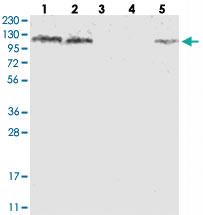 Anti-SKIV2L2 Rabbit Polyclonal Antibody