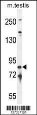 Anti-IFT81 Rabbit Polyclonal Antibody (AP (Alkaline Phosphatase))