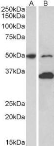 Anti-MKRN1 Antibody (A82810) (1µg/ml) staining of Mouse fetal (A) and adult (B) Brain lysates (35µg protein in RIPA buffer). Primary incubation was 1 hour. Detected by chemiluminescence.