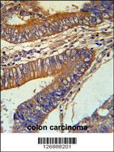 Anti-KLC3 Rabbit Polyclonal Antibody (Biotin)