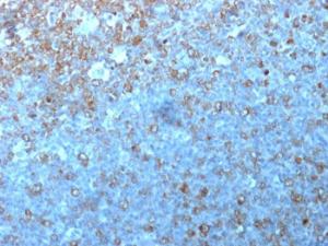 Antibody anti-CDK1 POH-1 BSAI 100 µg