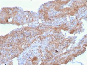 Immunohistochemical analysis of formalin-fixed, paraffin-embedded human lung using Anti-Fibronectin Antibody [FN1/2948]