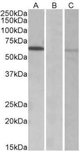 HEK293 lysate (10ug protein in RIPA buffer) over expressing Human MKRN1 with DYKDDDDK tag probed with Anti-MKRN1 Antibody (A82810) (0.3µg/ml) in Lane A and probed with anti- DYKDDDDK Tag (1/1000) in lane C