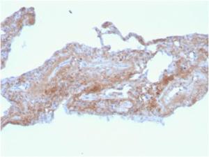 Immunohistochemical analysis of formalin-fixed, paraffin-embedded human lung using Anti-Fibronectin Antibody [FN1/2948]