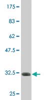 Anti-GALNT14 Mouse Monoclonal Antibody [clone: 2A8]