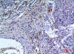 Immunohistochemical analysis of paraffin-embedded human lung using Anti-CD300LF Antibody