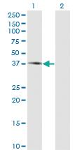 Anti-PIPOX Mouse Monoclonal Antibody [clone: 3D1]