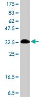 Anti-MIB1 Mouse Polyclonal Antibody