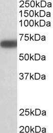 Anti-GAD1 Antibody (A82811) (1 µg/ml) staining of Mouse Brain lysate (35 µg protein in RIPA buffer) Primary incubation was 1 hour Detected by chemiluminescence