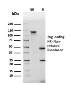 SDS-PAGE analysis of Anti-Fibronectin Antibody [FN1/2948] under non-reduced and reduced conditions; showing intact IgG and intact heavy and light chains, respectively. SDS-PAGE analysis confirms the integrity and purity of the antibody