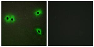 Immunofluorescence analysis of A549 cells using Anti-Collagen XIII alpha1 Antibody The right hand panel represents a negative control, where the antibody was pre-incubated with the immunising peptide