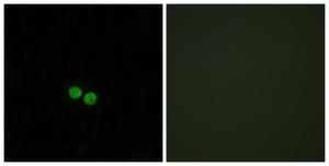 Immunofluorescence analysis of HepG2 cells using Anti-CDC25C Antibody. The right hand panel represents a negative control, where the antibody was pre-incubated with the immunising peptide