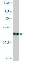 Anti-RNF103 Mouse Polyclonal Antibody