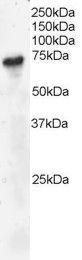 Anti-BLNK Antibody (A82812) staining (4 µg/ml) of Daudi lysate (RIPA buffer, 30µg total protein per lane). Primary incubated for 1 hour. Detected by western blot using chemilu minescence