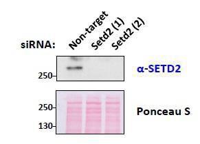 Anti-SETD2 Antibody (A84416) (05 µg/ml) staining of mouse fibroblast lysates transiently expressing different siRNA in second and third lane (35 µg protein in RIPA buffer) Primary incubation was 1 hour Detected by chemiluminescence