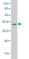 Anti-PRKG1 Mouse Monoclonal Antibody [clone: 5E5]