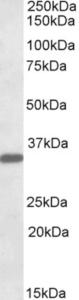 EB09652 (0.1 µg/ml) staining of Human Liver lysate (35 µg protein in RIPA buffer). Primary incubation was 1 hour. Detected by chemiluminescence.