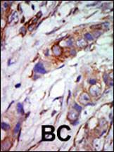 Anti-MAPK7 Rabbit Polyclonal Antibody (Biotin)