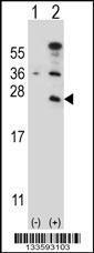 Anti-CD3E Rabbit Polyclonal Antibody (HRP (Horseradish Peroxidase))