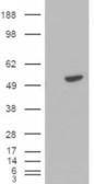 HEK293 overexpressing BLNK (RC202488) and probed with Anti-BLNK Antibody (A82812) (mock transfection in first lane), tested by Origene