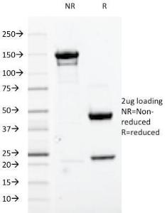 SDS-PAGE analysis of Anti-CDK1 Antibody [A1711] under non-reduced and reduced conditions; showing intact IgG and intact heavy and light chains, respectively SDS-PAGE analysis confirms the integrity and purity of the antibody