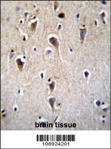 Anti-CRFR2D Rabbit Polyclonal Antibody (FITC (Fluorescein Isothiocyanate))