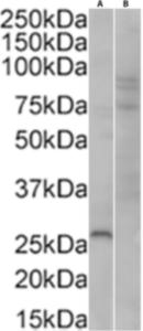 Western blot analysis of HEK293 cell lysates (30 µg protein in RIPA buffer) using Anti-GFP Antibody (A290) at a 1:5,000 dilution (1 hour incubation). The lanes contain: (A) HEK293 cells transfected with GFP expressing plasmid, (B) non-transfected HEK293 cells. Detected by chemiluminescence